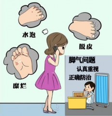 患上了脚气有什么症状特点