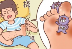 脚气脱皮怎样治好