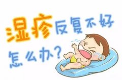 南京皮研所看湿疹哪个专家好?