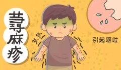 荨麻疹多久能消退