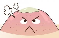 去医院皮肤科看痘痘贵吗